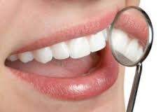 dental-implants-romania