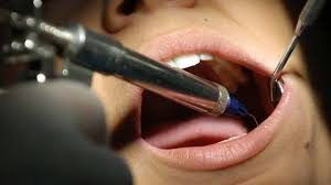 dental-implants-budapest